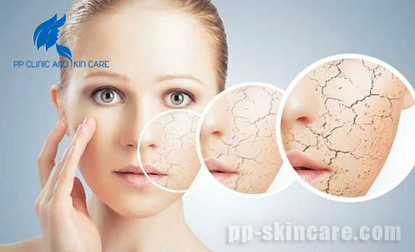 5 vấn đề thường gặp về da khô và biện pháp khắc phục