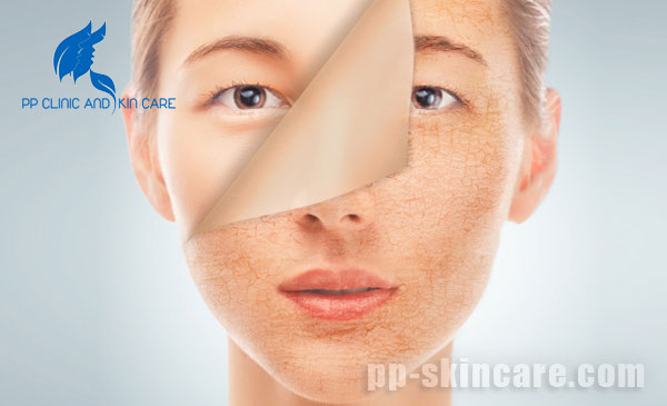 5 vấn đề thường gặp về da khô và biện pháp khắc phục