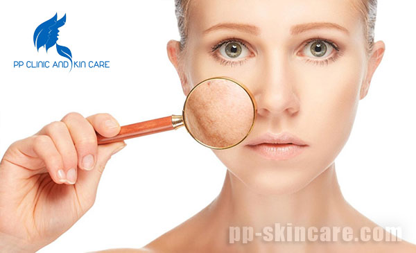 Các sản phẩm của PP Skin Care điều trị mụn và cải thiện nếp nhăn